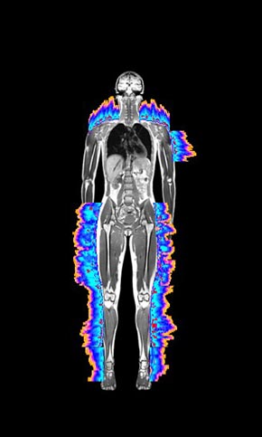 Whole-body signal map, anterior view — measured readout mapped to anatomy
