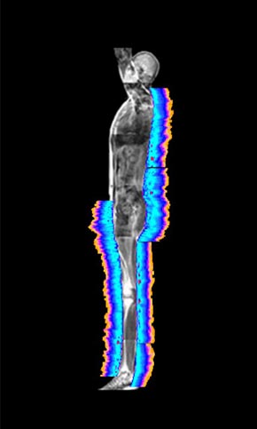 Whole-body signal map, lateral profile view — measured readout mapped to anatomy