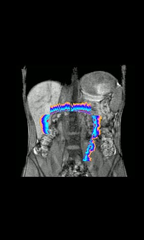 Abdominal signal map — measured readout mapped to the digestive region